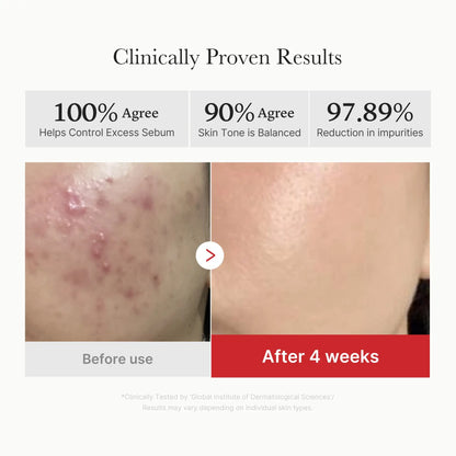 KOEC Succinic Acid Peel Pad